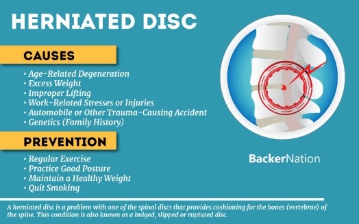 عوامل خطر فتق دیسک